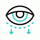 Blepharoplasty 10606565.gif